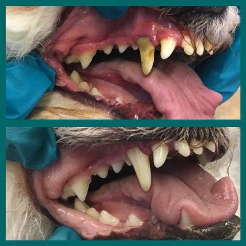 Before and After Professional Teeth Cleaning